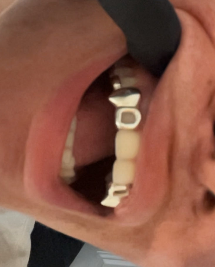 Silver Custom Window-Fang-Bar 3 Tooth Cap Top