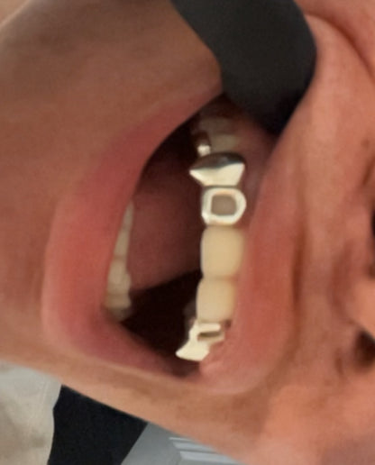 Silver Custom Window-Fang-Bar 3 Tooth Cap Top