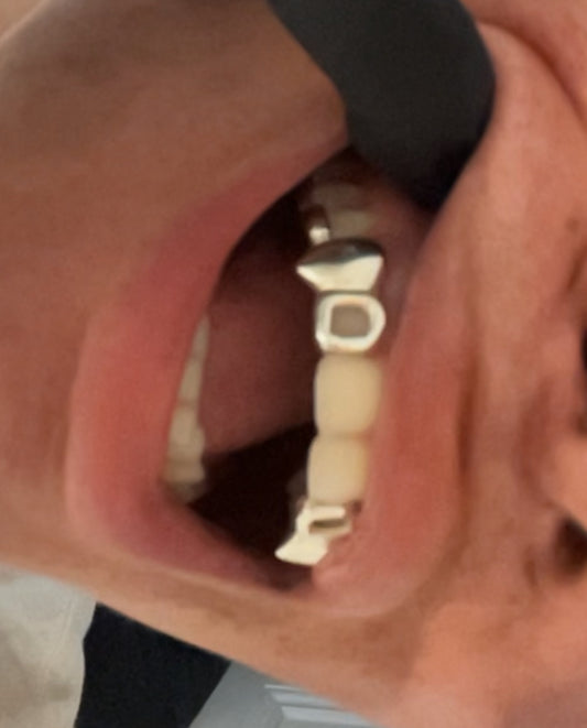 Silver Custom Window-Fang-Bar 3 Tooth Cap Top